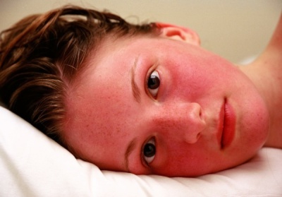 Rosacea tünetei és kezelése - Vörös foltok az idős emberek arcán