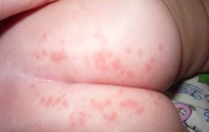elvețian fenomen rezervor alergie scutec pampers -  lostinabookafteradayofsocialwork.com