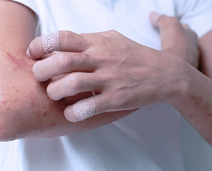 tratamentul mainilor varicoase din petropavlovsk
