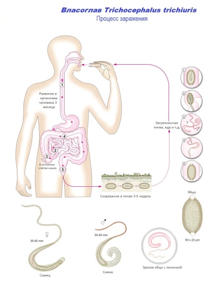Az ostorféreg belső szerkezete - Ostorféreg-fertőzés – Wikipédia