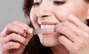 Чим відбілити зуби види відбілювачів зубів, правила використання в домашніх умовах,