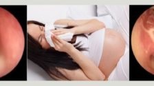 Алергічний риніт при вагітності симптоми, лікування, відгуки