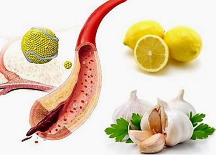 Імбир, лимон і мед для очищення судин (рецепти)