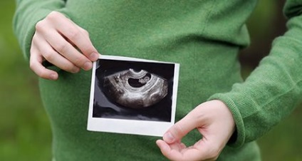 Узі при вагітності - терміни, призначення
