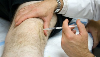 Хвороби колінного суглоба які бувають симптоми і лікування