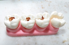 Відбілювання зубів в П'ятигорську ціни, контакти клінік