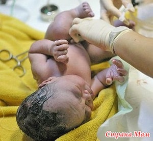 Як лікують гемолітичну хворобу новонароджених країна мам