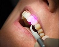 Терапія - «стоматологічна клініка тверстом»