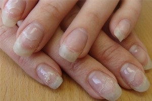 Чи шкідливий гель-лак для нігтів відгуки лікарів
