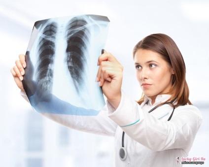 Що таке кальцинати в легенях здоров'я інфо
