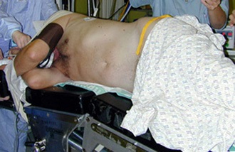 Положення пацієнта на операційному столі під час анестезії - вся правда про наркоз