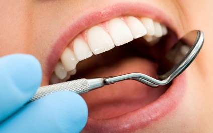 Як позбутися від карієсу в домашніх умовах, як очистити зуби, здоровонлайн