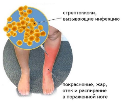 diabétesz fájó lábak kezelése népi jogorvoslat