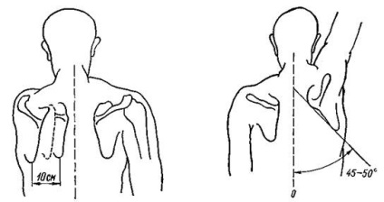 Амплітуда рухів руки - плечовий пояс і плечовий суглоб - ортопедична діагностика - мед читалка