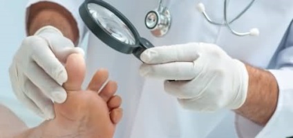 Оніхомікоз нігтів лікування, препарати