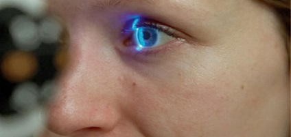 Пігментна глаукома очі (синдром пігментного дисперсії) - причини, прогнози і лікування в Москві