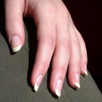 Плями на нігтях рук що робити