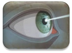 Хірургія глаукоми - діагностика і лікування глаукоми, операція при глаукомі в Нижньому Новгороді -
