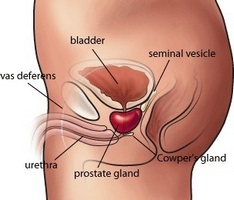 din adenom și exerciții de prostatită consecințele prostatitei stagnante