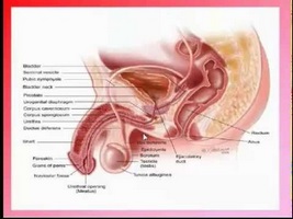 cum este operația de îndepărtare a adenomului de prostată diagnostico del cancer de prostata