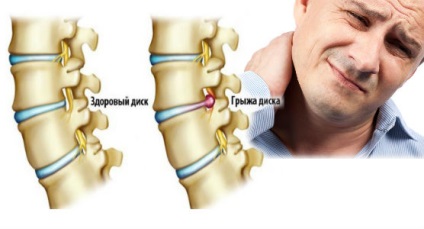 Шийна грижа лікування народними засобами