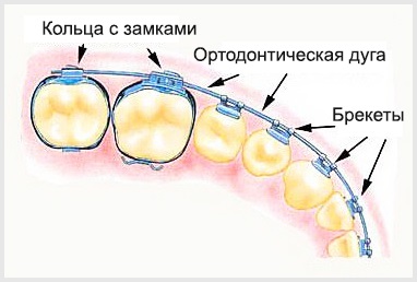 Виправлення прикусу зубів у дорослих - ціни в Краснодарі