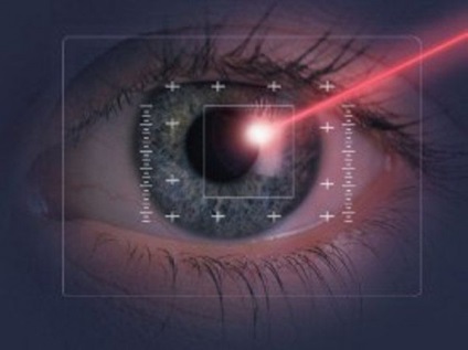 Лікування глаукоми лазером переваги, недоліки