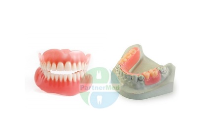 Знімні зубні протези, ціни в щелково на протезування повними або частковими протезами,