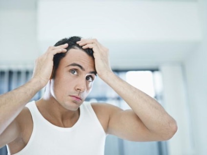 Випадання волосся у чоловіків в ранньому віці причини і лікування косметичними та народними засобами