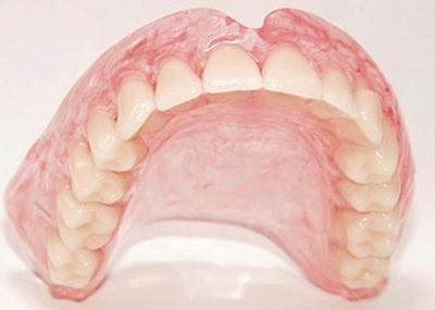 Зубні протези Акрі фрі - новинка в сфері протезування - про виправлення прикусу і брекети