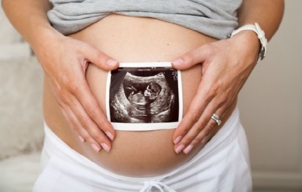 3Д УЗД при вагітності - коли робити, на які терміни, як часто можна робити узі