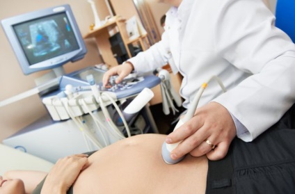 3Д УЗД при вагітності - коли робити, на які терміни, як часто можна робити узі