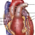 Інфаркт легені - медичний журнал