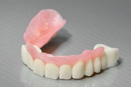 Зубний протез сендвіч характеристики, свідчення, виготовлення та встановлення