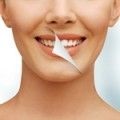 Засіб для відбілювання зубів в аптеках гель і інші препарати