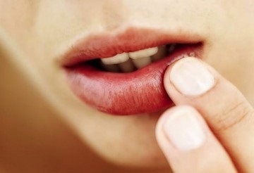 Як лікувати прищі на губі види висипань і способи їх позбутися