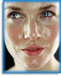 Жирна шкіра обличчя (принципи догляду)