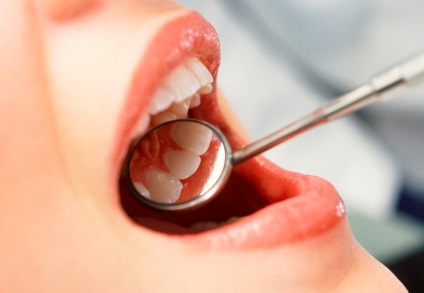 Гострий зубний біль, що допомагає від зубного болю