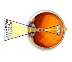 Рефракція ока - будову і функції, діагностика і захворювання - сайт - московська офтальмологія