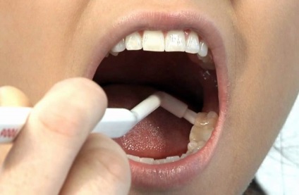 Монопучкова зубна щітка особливості використання та догляду