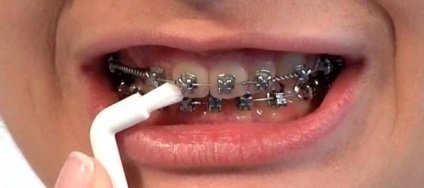 Монопучкова зубна щітка особливості, правила вибору, огляд моделей