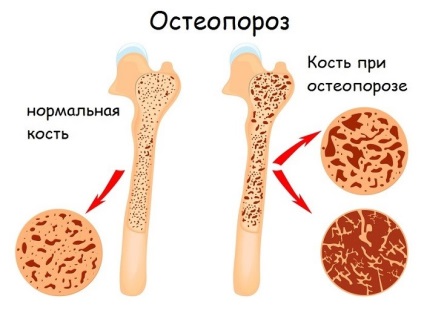 Вітаміни з кальцієм для дітей і для підлітків які краще