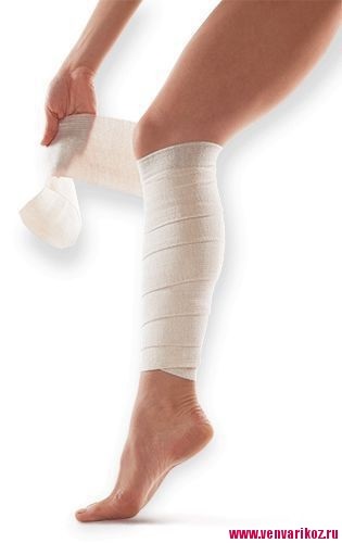 Ciorapi de compresie sau bandaj elastic, Compresie elastica bandaj pentru varicoza