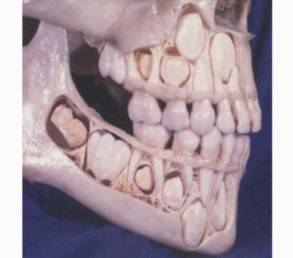 Як виглядає фото щелепи дитини з молочними зубами