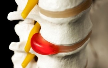 М'язовий біль в спині (біль у м'язах) причини і фактори розвитку