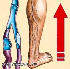 Профілактичний масаж ніг при варикозі