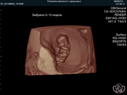 3Д 4д узи при вагітності, вартість УЗД в П'ятигорську, курортна клініка жіночого здоров'я