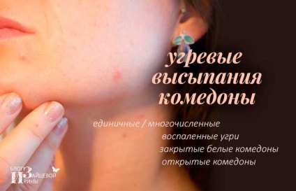 Як визначити тип шкіри обличчя, блог Ірини Зайцевої