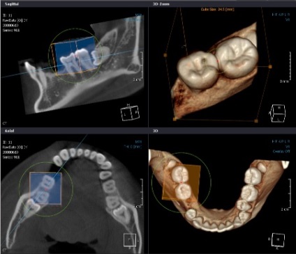 Комп'ютерна томографія в стоматології, поліклініка доктор алекс, харків