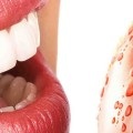 Пародонтоз зубів - лікування народними засобами як лікувати народними методами (фото), всенародні